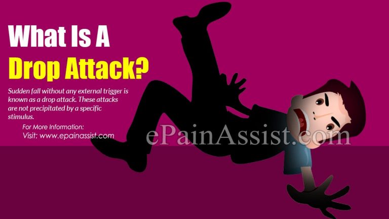 Drop Attack: Causes, Symptoms, Treatment, Diagnosis