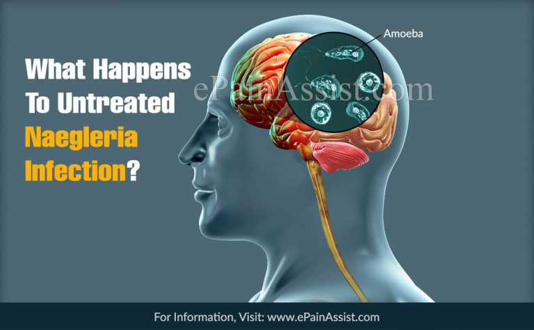 What Happens To Untreated Naegleria Infection?