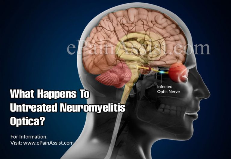 What Happens To Untreated Neuromyelitis Optica & When To Go To The Doctor?