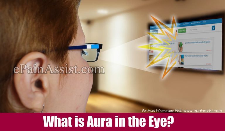 What is Aura in the Eye & What Causes an Aura in the Eye?
