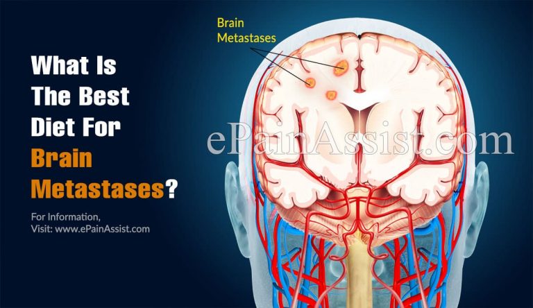 What Is The Best Diet For Brain Metastases?
