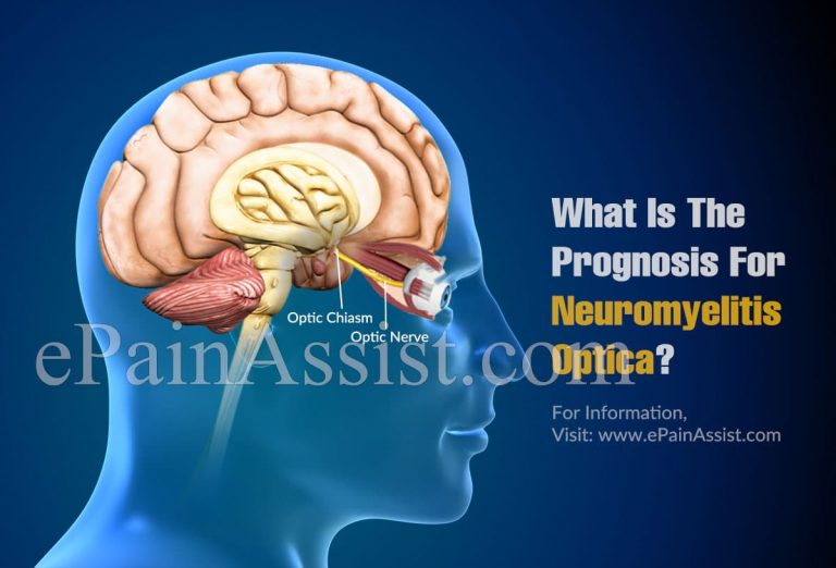 What Is The Prognosis For Neuromyelitis Optica?