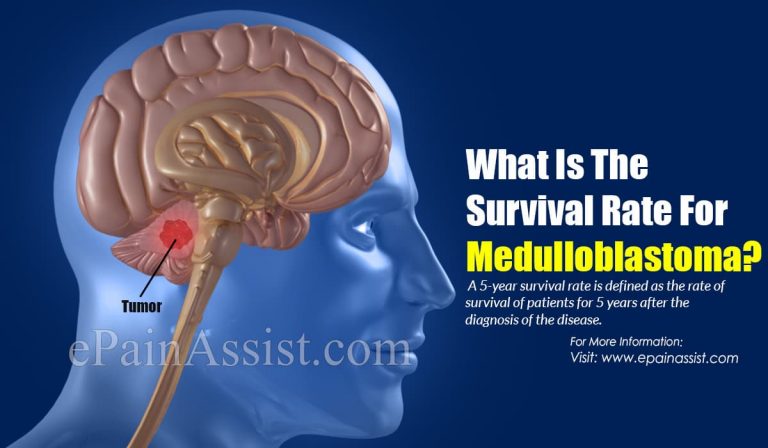 What Is The Survival Rate For Medulloblastoma?