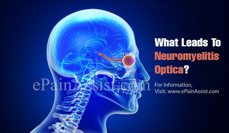 What Leads To Neuromyelitis Optica & Can It Be Cured?