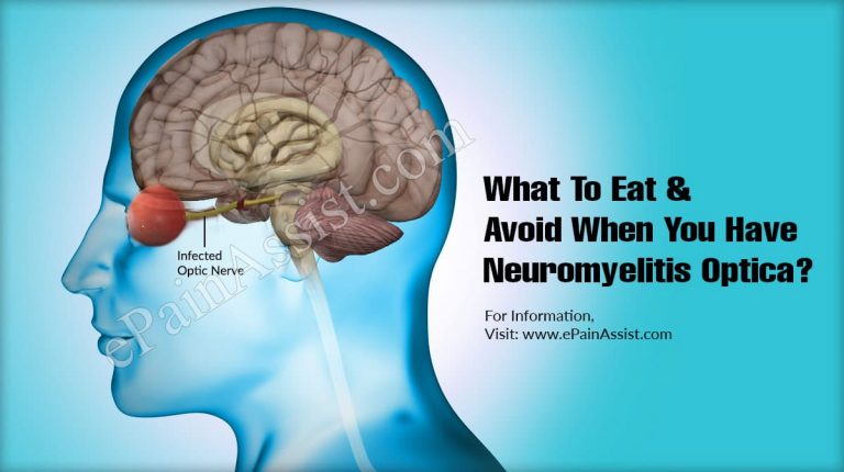 What To Eat & Avoid When You Have Neuromyelitis Optica?