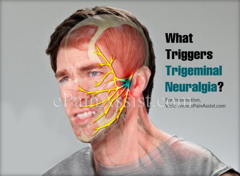 What Triggers Trigeminal Neuralgia & Is It The Most Painful Condition?
