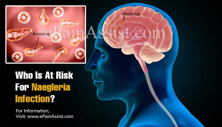 Who Is At Risk For Naegleria Infection?