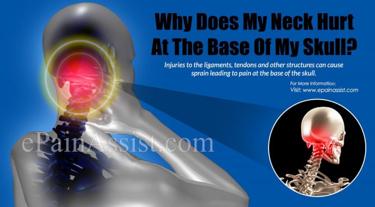 Why Does My Neck Hurt At The Base Of My Skull?