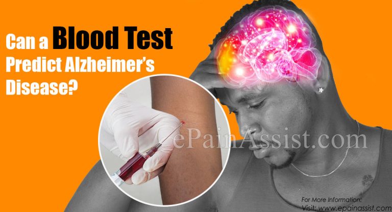 Can a Blood Test Predict Alzheimer’s Disease?