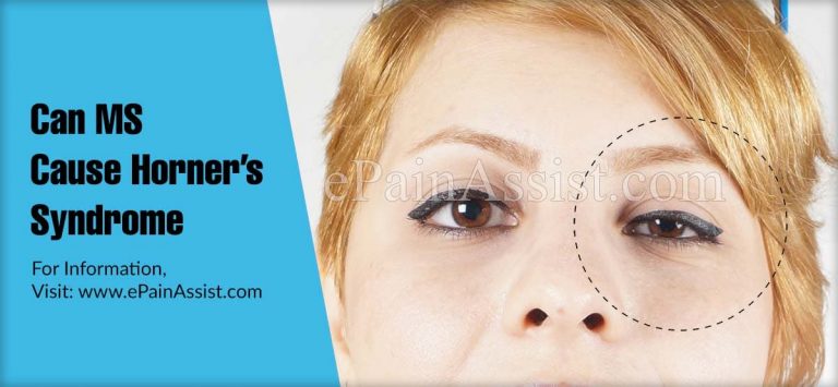 Can MS Cause Horner’s Syndrome & Can Botox Cause It?