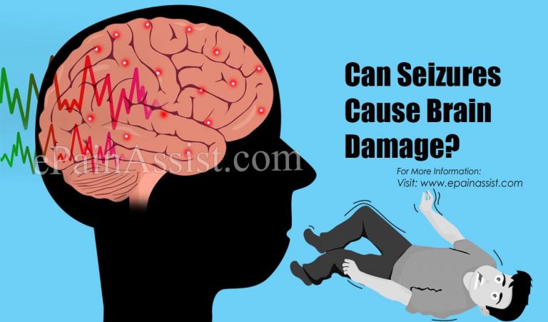 Can Seizures Cause Brain Damage?
