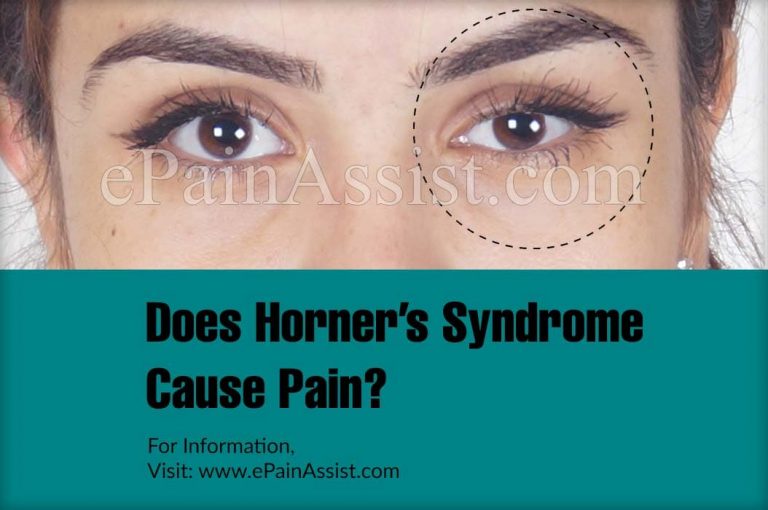 Does Horner’s Syndrome Cause Pain & What Does It Look Like?