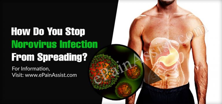 How Do You Stop Norovirus Infection From Spreading?