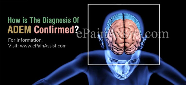 How is The Diagnosis Of Acute Disseminated Encephalomyelitis (ADEM) Confirmed