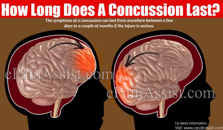 How Long Does A Concussion Last & What To Do And Not To Do In A Concussion