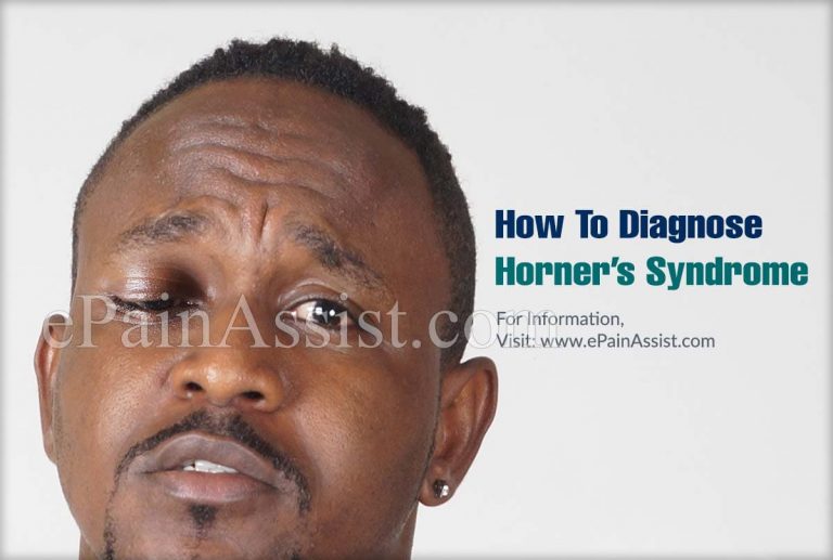 How To Diagnose Horner’s Syndrome & What Is The Best Medicine For It?