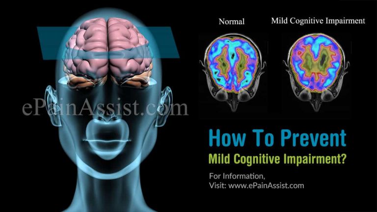 How To Prevent Mild Cognitive Impairment?