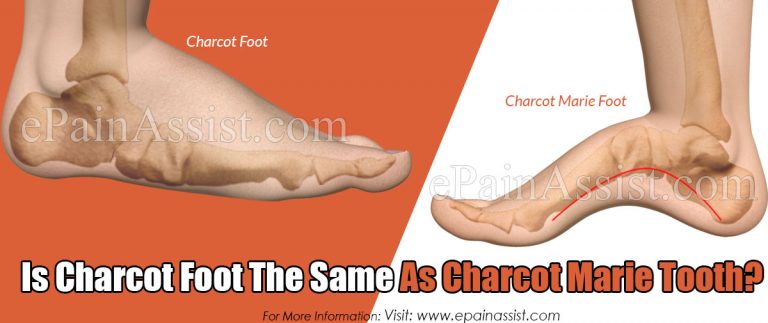Is Charcot Foot The Same As Charcot Marie Tooth?