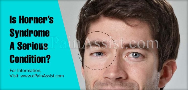 Is Horner’s Syndrome A Serious Condition & Can It Be Reversed?