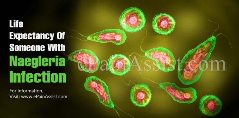 Life Expectancy Of Someone With Naegleria Infection