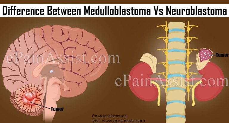 Medulloblastoma Vs Neuroblastoma Differences