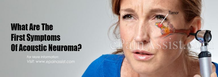 What Are The First Symptoms Of Acoustic Neuroma & How Do You Test For It?