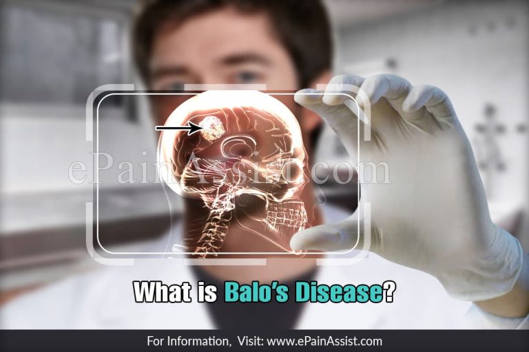 What are the Symptoms of Balo’s Disease?