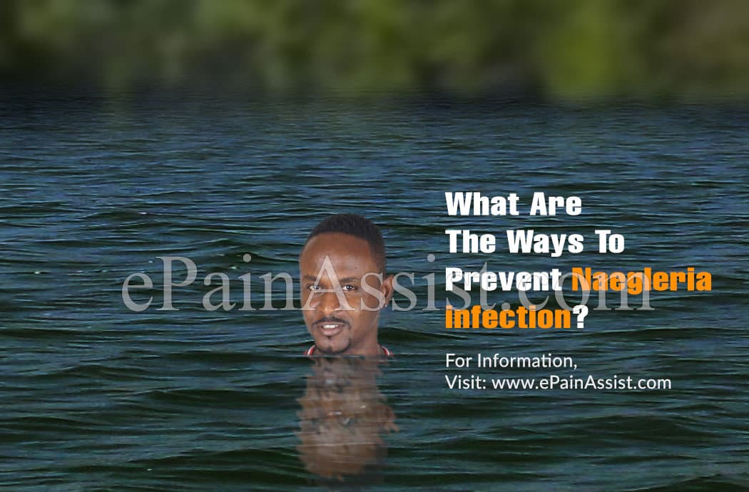 What Are The Ways To Prevent Naegleria infection?