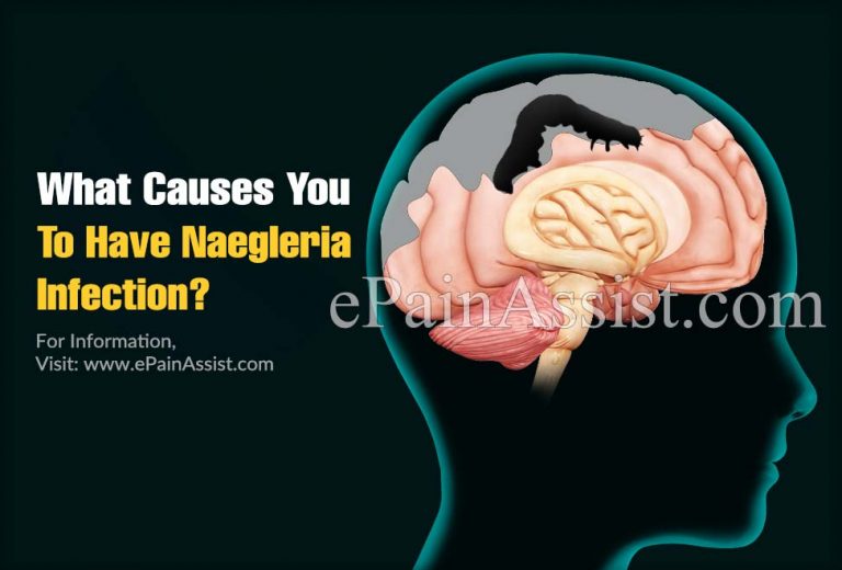 What Causes You To Have Naegleria Infection?