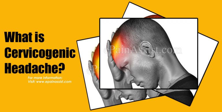 What is Cervicogenic Headache | Causes | Symptoms | Treatment