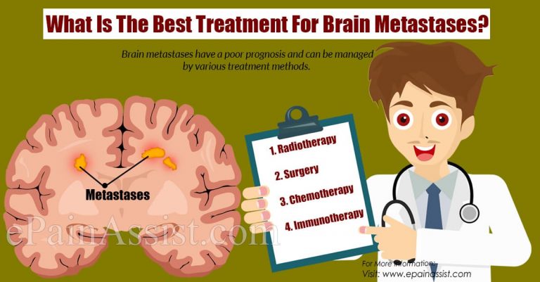 What Is The Best Treatment For Brain Metastases?