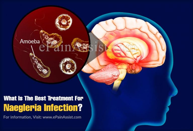 What Is The Best Treatment For Naegleria Infection?