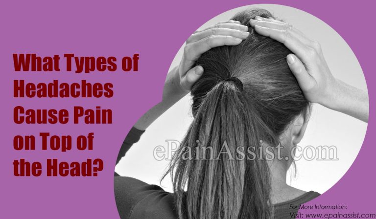 What Types of Headaches Cause Pain on Top of the Head & How to Treat It?