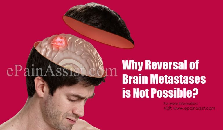 Why Reversal of Brain Metastases is Not Possible?
