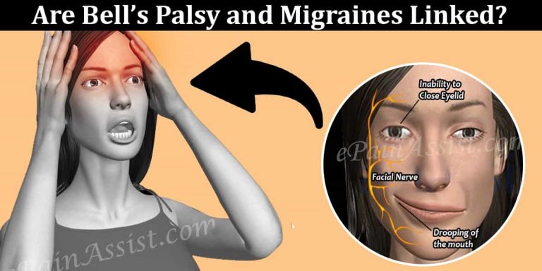 Are Bell’s Palsy and Migraines Linked?