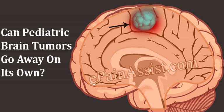 Can Pediatric Brain Tumor Go Away On Its Own & What Are Its Natural Remedies?