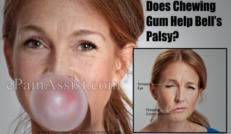 Does Chewing Gum Help Bell’s Palsy & What About Ice & Heat?