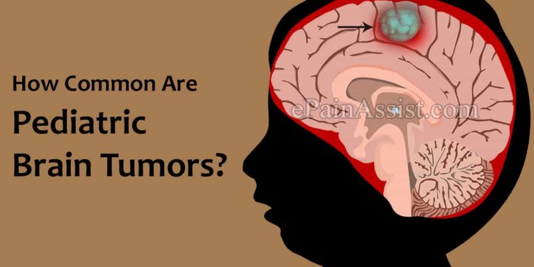 How Common Are Pediatric Brain Tumors Or Are They Rare & How Does Pediatric Brain Tumors Affect The Body & What Triggers It?