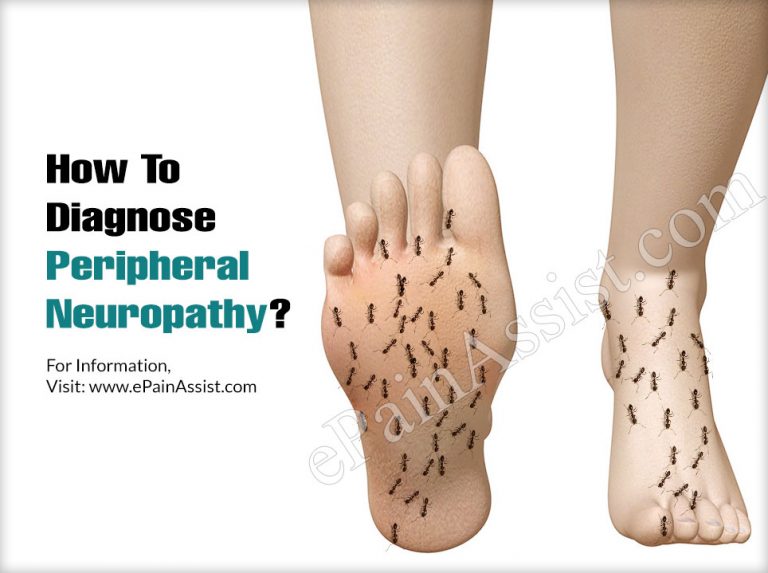 How To Diagnose Peripheral Neuropathy & What Is The Best Medicine For It?