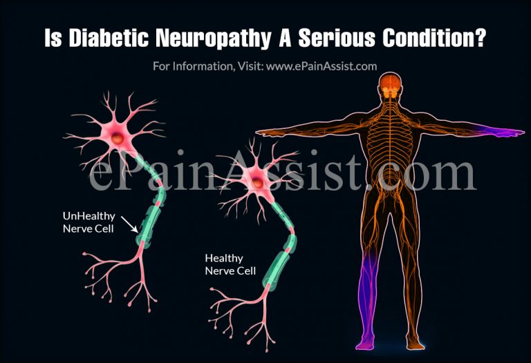 Is Diabetic Neuropathy A Serious Condition & Can It Be Reversed?