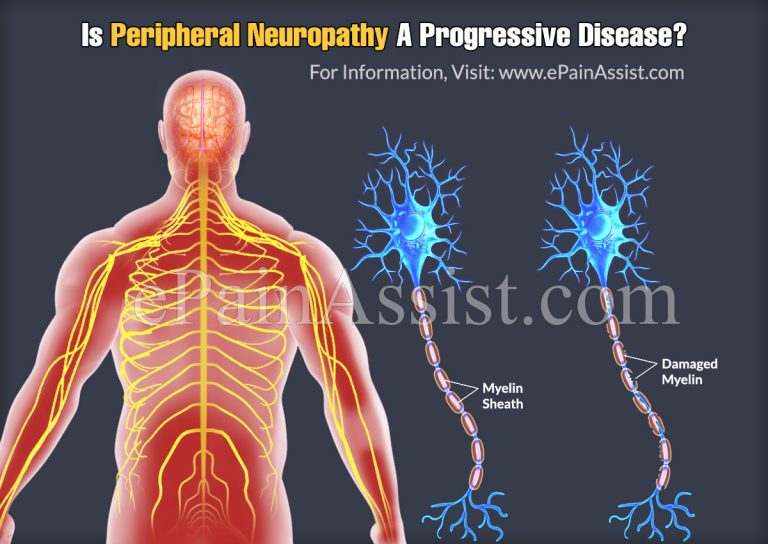 Is Peripheral Neuropathy A Progressive Disease & What Are Alternative Treatments For It?