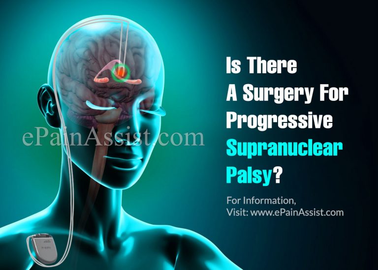 Is There A Surgery For Progressive Supranuclear Palsy?