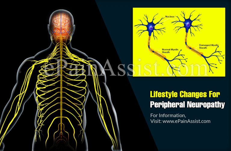 Lifestyle Changes For Peripheral Neuropathy
