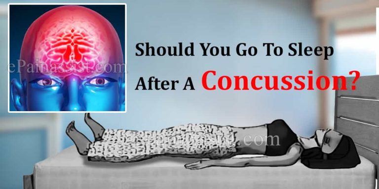 Should You Go To Sleep After A Concussion?