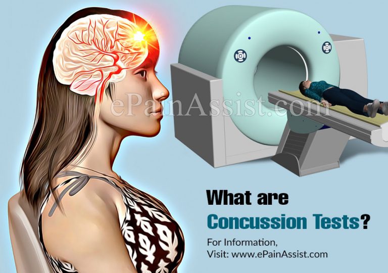 What are Concussion Tests & What is it Used For?