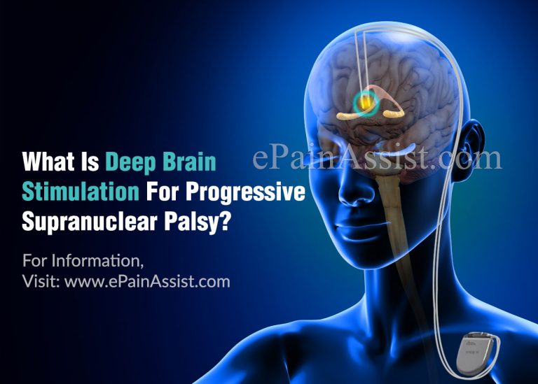 What Is Deep Brain Stimulation For Progressive Supranuclear Palsy?