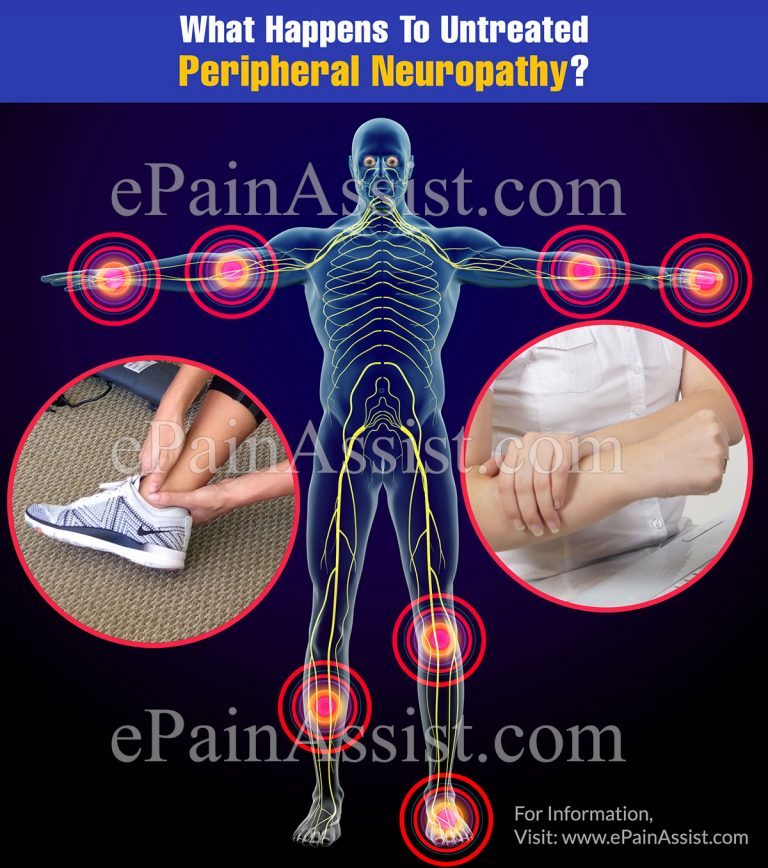 What Happens To Untreated Peripheral Neuropathy & When To Go To Doctor?