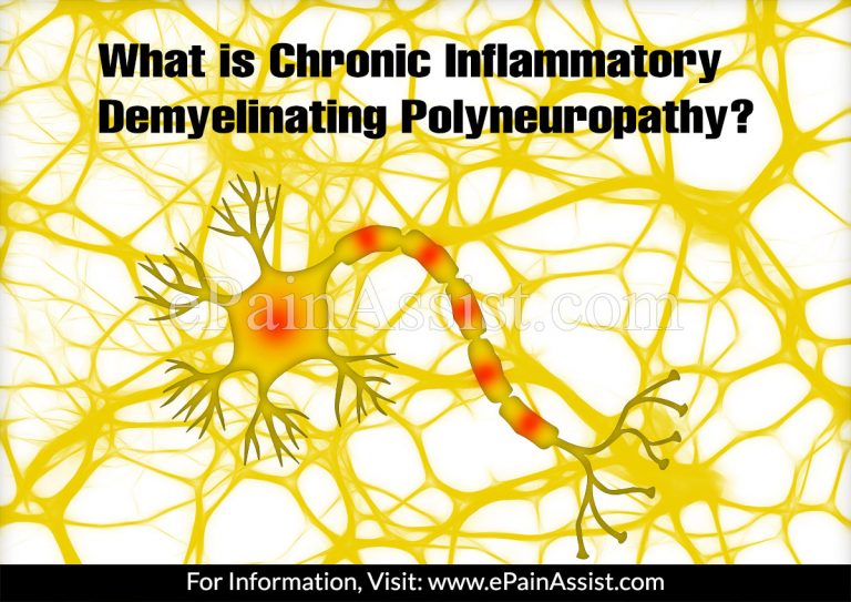 What is Chronic Inflammatory Demyelinating Polyneuropathy & How is it Treated?