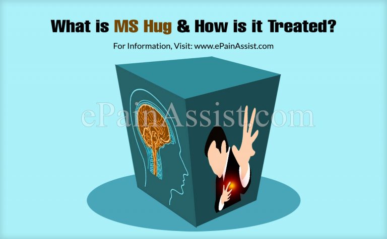What is MS Hug & How is it Treated?
