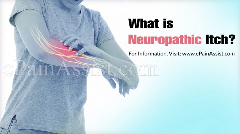 Neuropathic Itch: Causes, Symptoms, Treatment, Prognosis